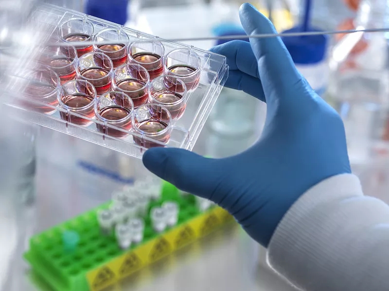 間充質干細胞治療阿爾茨海默病的臨床前研究 間充質干細胞治療阿爾茨海默病的臨床前研究