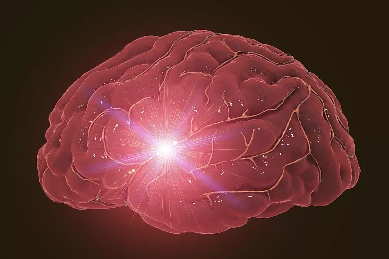 福建醫科大學:干細胞和外泌體在治療腦出血中的臨床研究進展