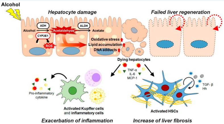 酒精及其代謝物通過各種途徑和/或機制共同促進ALD的發病機制。(如圖1) 酒精及其代謝物通過各種途徑和/或機制共同促進ALD的發病機制。(如圖1)