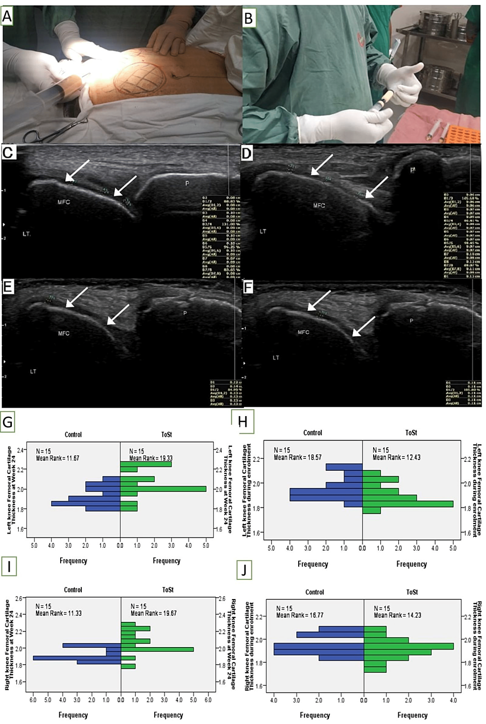 圖1：TSC制備步驟和干預前后的軟骨厚度測量