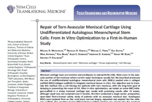間充質(zhì)干細胞能夠幫助修復受損的半月板組織,不用手術(shù)切除受傷部位也能讓膝關(guān)節(jié)功能恢復正常。
