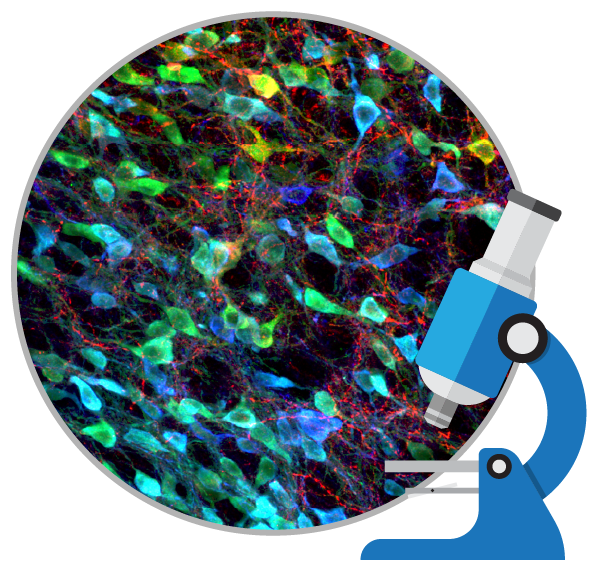 盤(pán)點(diǎn):干細(xì)胞移植治療帕金森病的臨床研究進(jìn)展