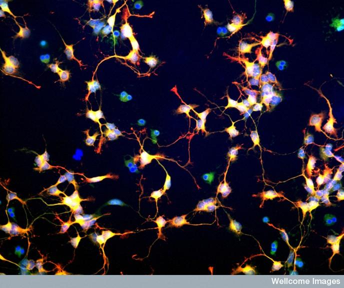 中科神經(jīng)干細(xì)胞 中科神經(jīng)干細(xì)胞