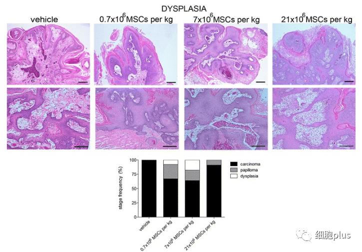 在增生期,全身注射同種異體間充質干細胞不會增加腫瘤的惡性程度。 在增生期,全身注射同種異體間充質干細胞不會增加腫瘤的惡性程度。
