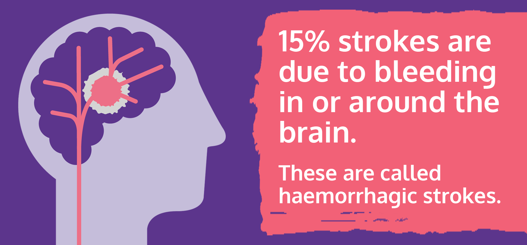 什么是出血性中風?