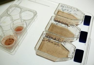 用生長因子培養(yǎng)的胚胎和誘導(dǎo)多能 (iPS) 干細(xì)胞變得有色素(棕色)并顯示出視網(wǎng)膜色素上皮細(xì)胞的特征