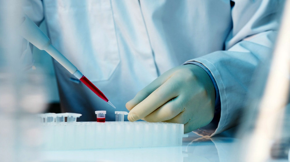 什么是干細胞移植-干細胞移植的流程和優勢