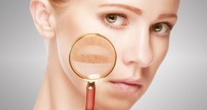 間充質干細胞治療系統性紅斑狼瘡 間充質干細胞治療系統性紅斑狼瘡