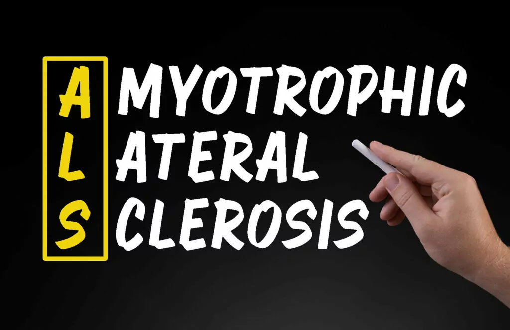 干細(xì)胞治療背景下的肌萎縮側(cè)索硬化癥 干細(xì)胞治療背景下的肌萎縮側(cè)索硬化癥