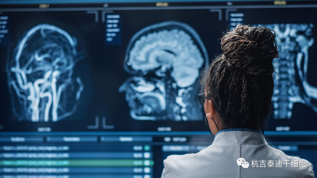 干細胞治療神經(jīng)退行性疾病臨床試驗研究進展 干細胞治療神經(jīng)退行性疾病臨床試驗研究進展