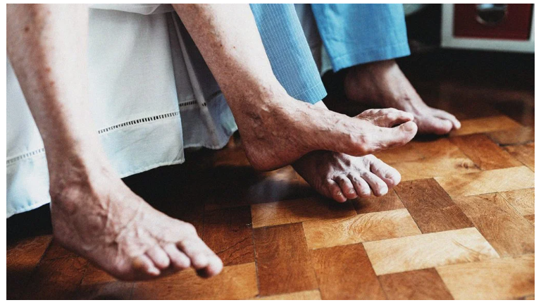 類風濕關節炎癥狀