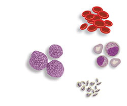 用于移植的干細(xì)胞可以來自骨髓或血液 用于移植的干細(xì)胞可以來自骨髓或血液