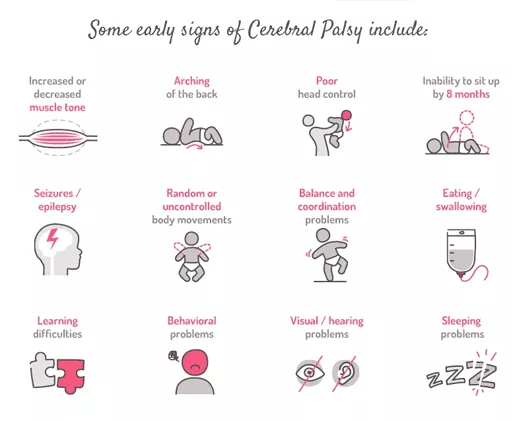 腦癱早期癥狀 腦癱早期癥狀