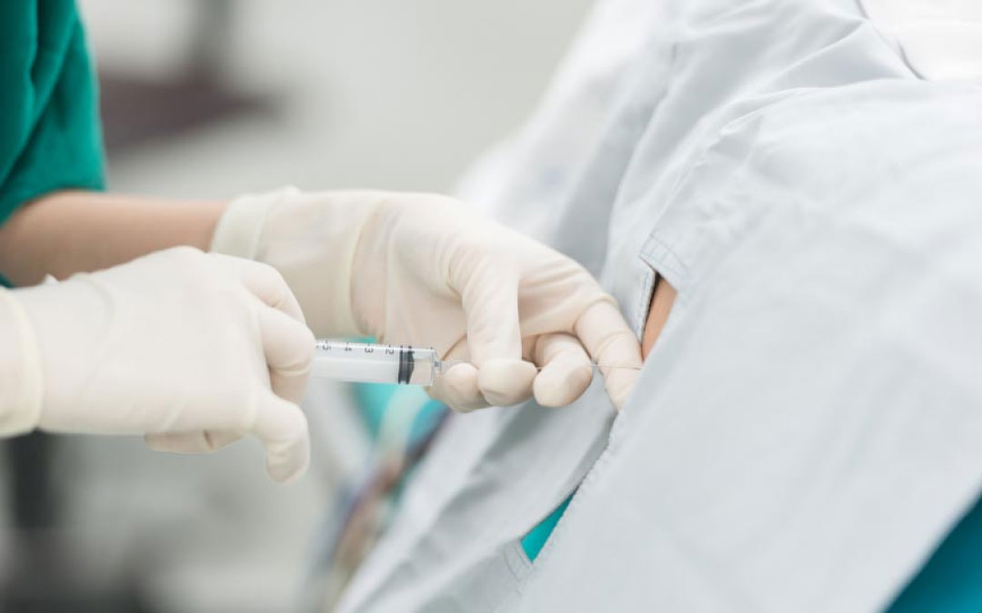 坐骨神經(jīng)痛的干細胞療法 坐骨神經(jīng)痛的干細胞療法