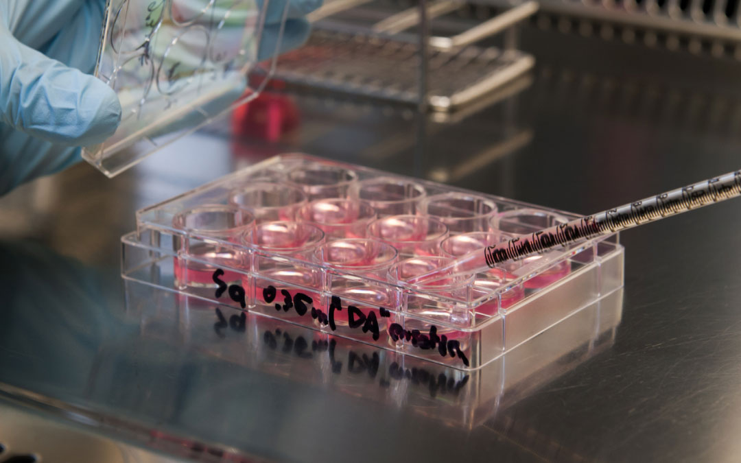 踝關節(jié)疼痛的干細胞療法