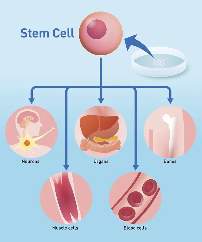 自體干細胞移植:工作原理、益處和風險 自體干細胞移植:工作原理、益處和風險