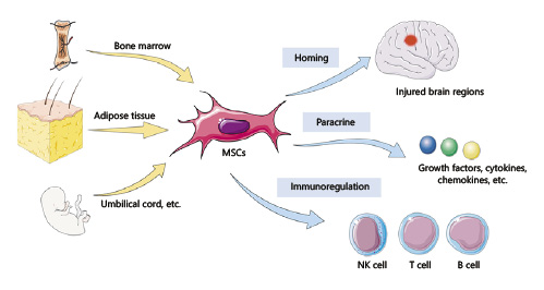 間充質干細胞治療神經退行性疾病的機制 間充質干細胞治療神經退行性疾病的機制