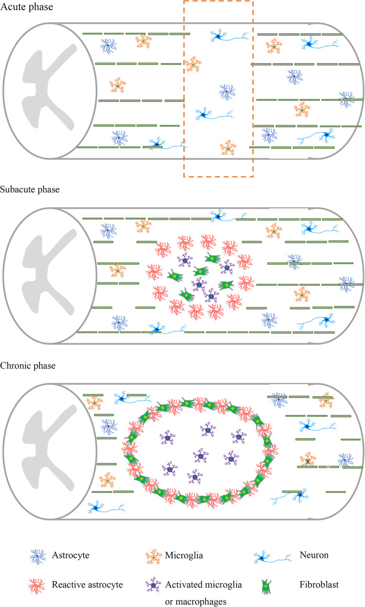 圖1:脊髓損傷不同階段的病理特點。 圖1:脊髓損傷不同階段的病理特點。
