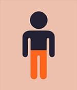 雙側腦癱,影響雙腿或雙臂。 雙側腦癱,影響雙腿或雙臂。