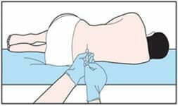 鞘內(nèi)給藥 鞘內(nèi)給藥