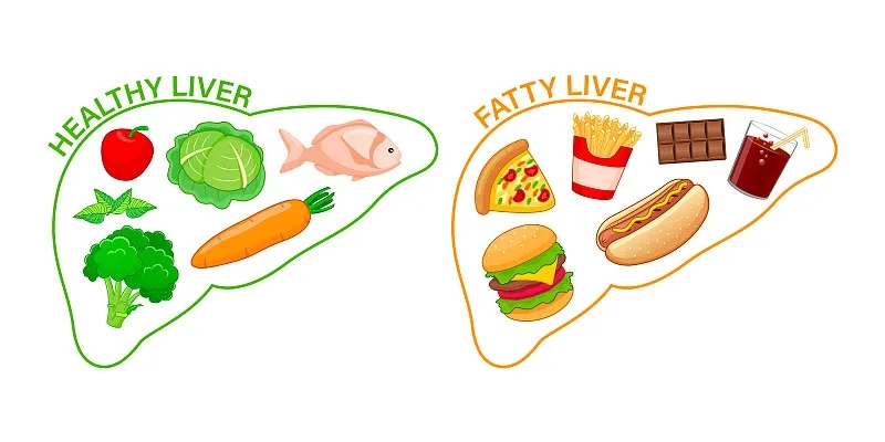 如何才能讓我的肝臟恢復健康? 如何才能讓我的肝臟恢復健康?