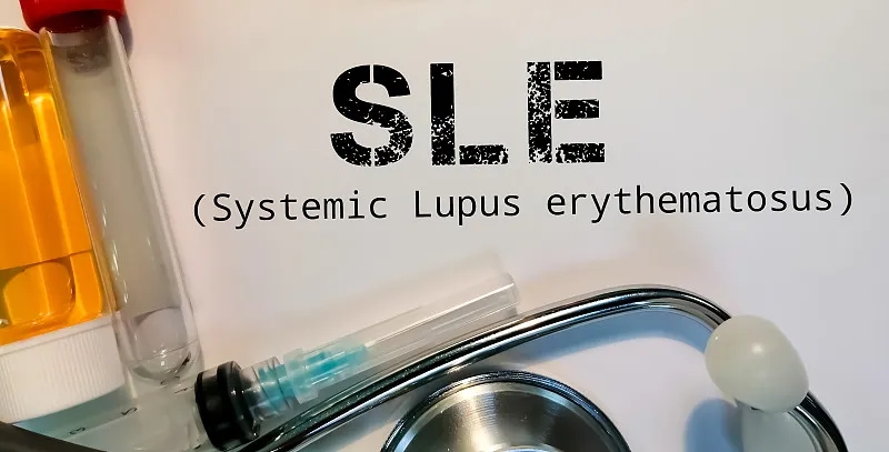 南京鼓樓醫院:干細胞治療在系統性紅斑狼瘡中維持長期治療效果 南京鼓樓醫院:干細胞治療在系統性紅斑狼瘡中維持長期治療效果
