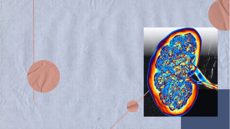 急性腎損傷與腎衰竭:它們有何不同? 急性腎損傷與腎衰竭:它們有何不同?