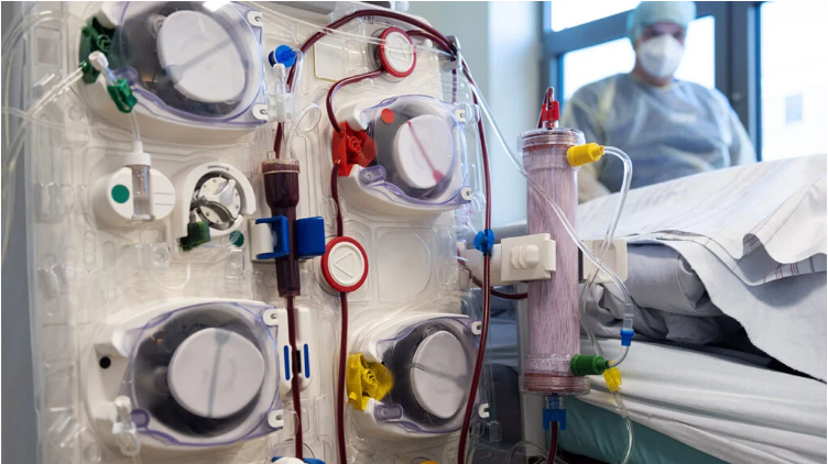 急性腎損傷癥狀和原因是什么?及其治療方法 急性腎損傷癥狀和原因是什么?及其治療方法