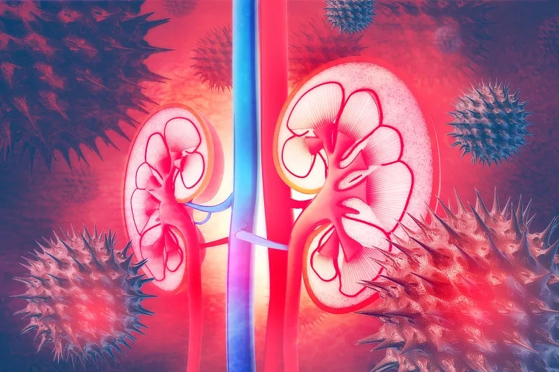 常見問題解答:IgA腎病的進展 常見問題解答:IgA腎病的進展