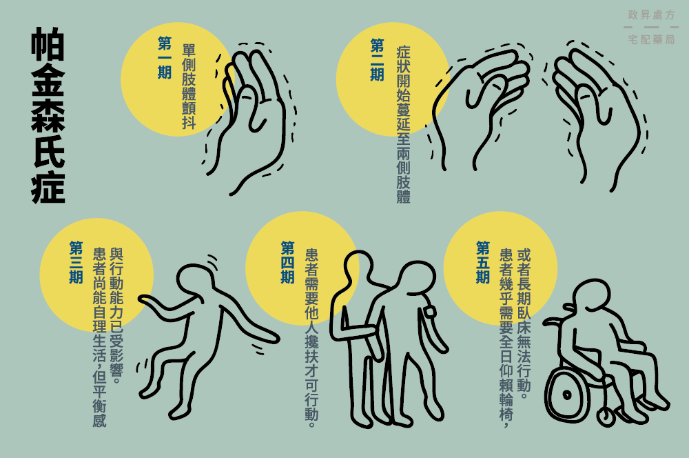 神經干細胞移植管理帕金森病:挑戰、納米技術支持和前景 神經干細胞移植管理帕金森病:挑戰、納米技術支持和前景