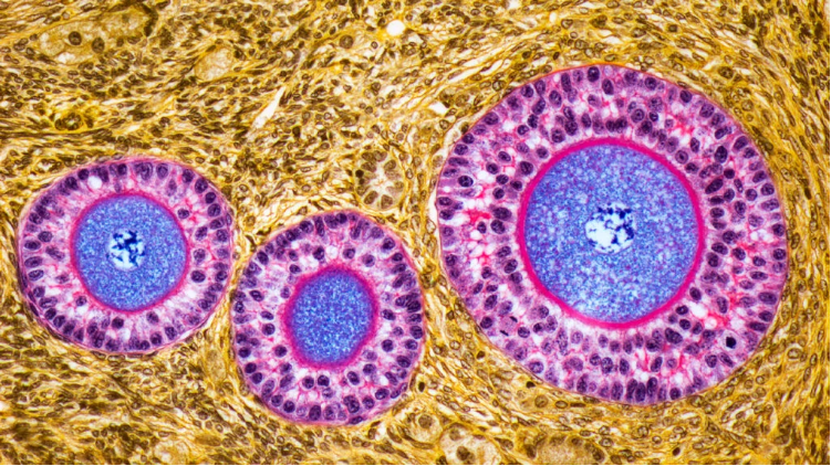 卵巢早衰體征和癥狀是什么?及其治療方法 卵巢早衰體征和癥狀是什么?及其治療方法
