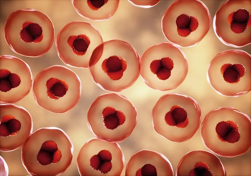 第一位接受Gamida Cell擴展臍帶血細胞療法 Omisirge?治療的患者 第一位接受Gamida Cell擴展臍帶血細胞療法 Omisirge?治療的患者