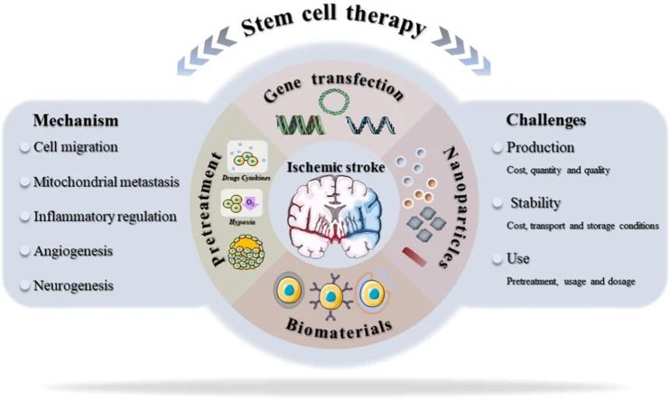 干細胞治療中風(fēng)新進展:一項206人的隨機臨床試驗結(jié)果揭曉啦! 干細胞治療中風(fēng)新進展:一項206人的隨機臨床試驗結(jié)果揭曉啦!