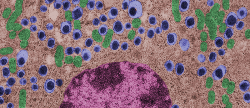 利用間充質干細胞治療1型糖尿病的潛力如何? 利用間充質干細胞治療1型糖尿病的潛力如何?