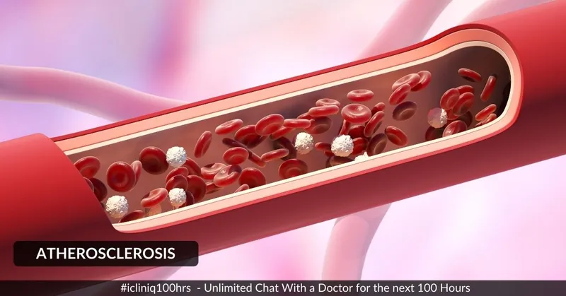 動脈粥樣硬化的體征和癥狀是什么?治療方案有哪些? 動脈粥樣硬化的體征和癥狀是什么?治療方案有哪些?