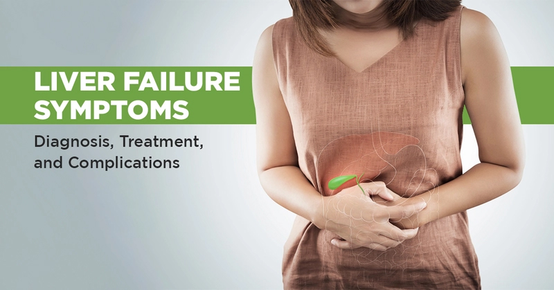 肝衰竭的體征和癥狀是什么?及其治療方法 肝衰竭的體征和癥狀是什么?及其治療方法