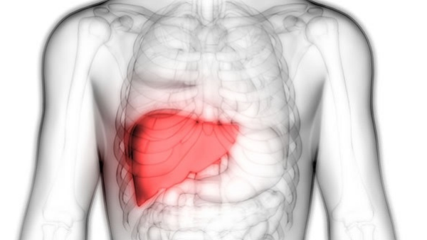 面對肝衰竭,你知道如何選擇最佳治療方案嗎? 面對肝衰竭,你知道如何選擇最佳治療方案嗎?