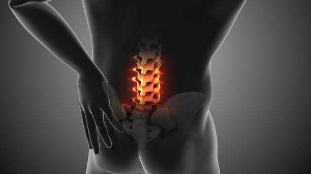 干細胞治療強直性脊柱炎的臨床案例有哪些? 干細胞治療強直性脊柱炎的臨床案例有哪些?