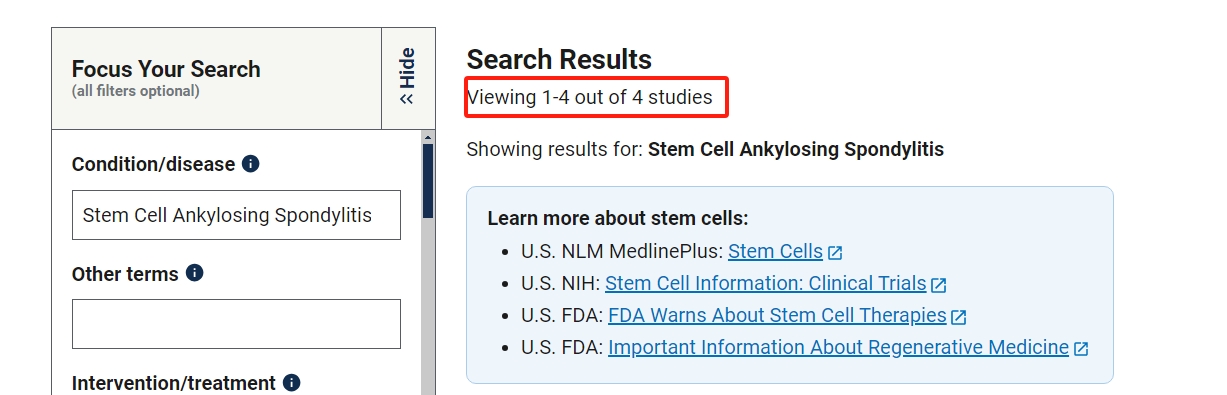 clinicaltrials.gov網站上注冊的有關干細胞治療強直性脊柱炎的臨床研究項目有4項。其中已完成的有1項。 clinicaltrials.gov網站上注冊的有關干細胞治療強直性脊柱炎的臨床研究項目有4項。其中已完成的有1項。