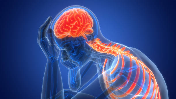 什么是缺血性腦中風(fēng),癥狀、原因、診斷和治療 什么是缺血性腦中風(fēng),癥狀、原因、診斷和治療