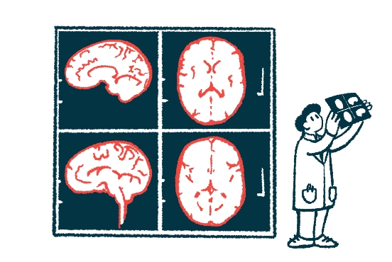 MRI精準給藥系統用于干細胞治療帕金森癥的臨床試驗 MRI精準給藥系統用于干細胞治療帕金森癥的臨床試驗