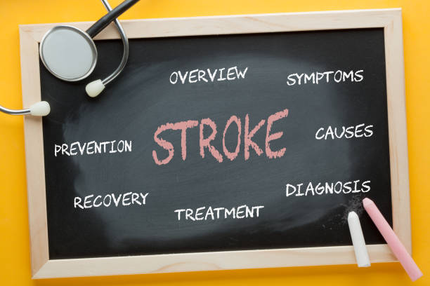 科普丨什么是中風?干細胞治療中風的機制與臨床研究進展 科普丨什么是中風?干細胞治療中風的機制與臨床研究進展