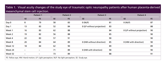 2021年干細胞治療神經病變臨床案例 2021年干細胞治療神經病變臨床案例