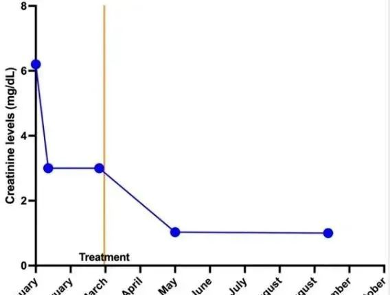 2020年干細(xì)胞治療慢性腎病臨床案例 2020年干細(xì)胞治療慢性腎病臨床案例