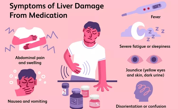 藥物導(dǎo)致肝衰竭的早期跡象 藥物導(dǎo)致肝衰竭的早期跡象