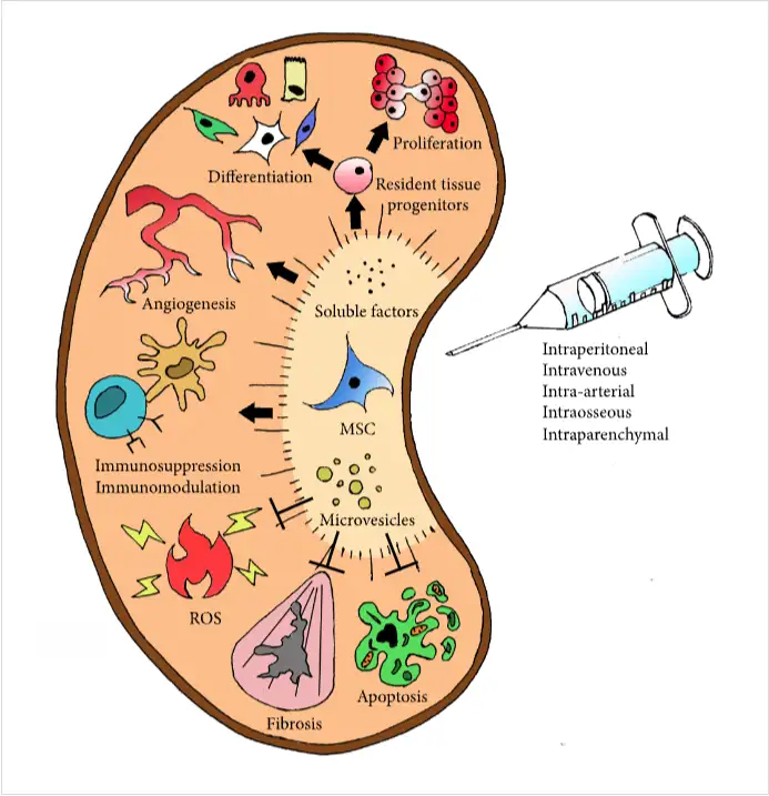 干細胞如何治療腎臟疾病? 干細胞如何治療腎臟疾病?