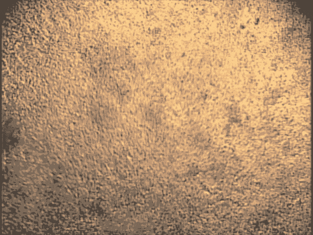 培養(yǎng)皿中的心臟干細(xì)胞 培養(yǎng)皿中的心臟干細(xì)胞