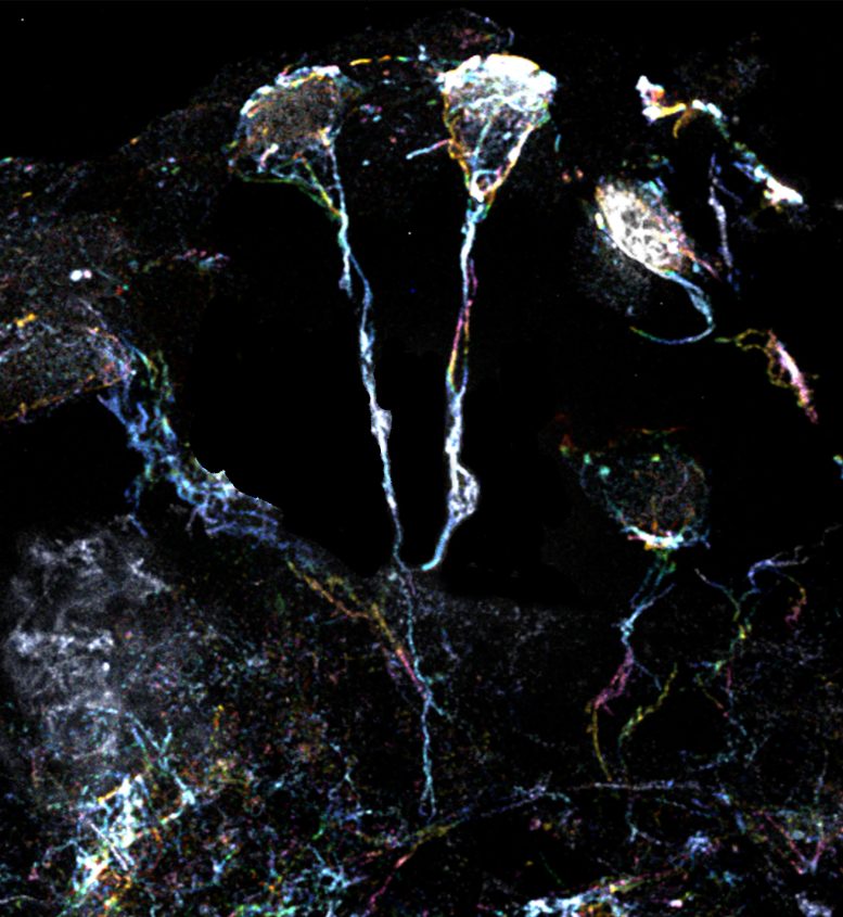 果蠅大腦中處于休眠狀態的神經干細胞具有富含肌動蛋白絲的突起 果蠅大腦中處于休眠狀態的神經干細胞具有富含肌動蛋白絲的突起