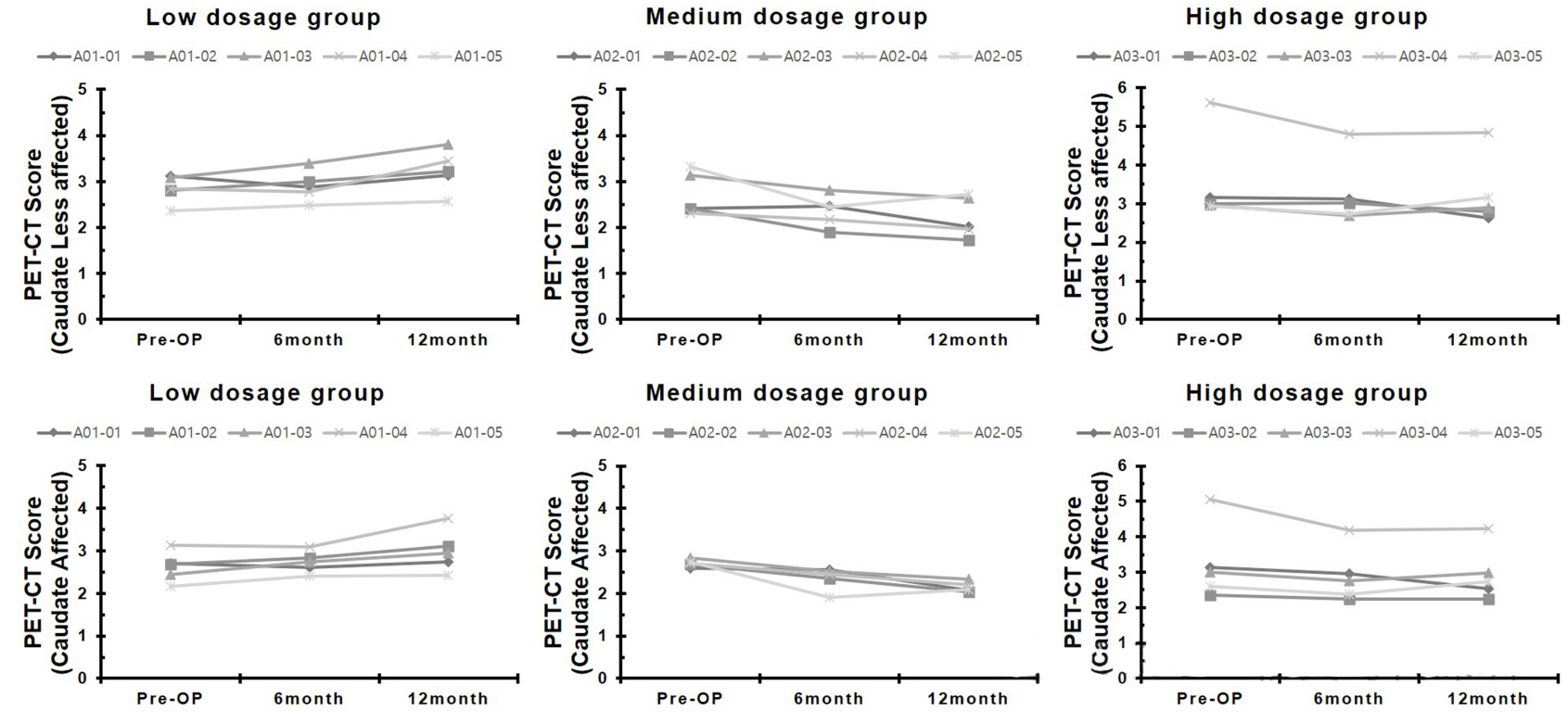 帕金森病評分量表(UPDRS) 帕金森病評分量表(UPDRS)