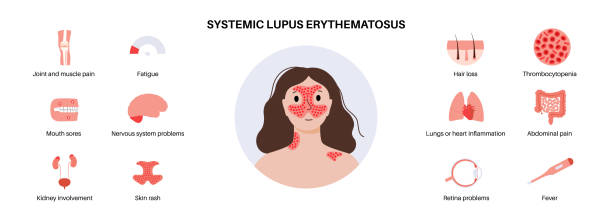 紅斑狼瘡會(huì)對(duì)患者壽命造成影響嗎? 紅斑狼瘡會(huì)對(duì)患者壽命造成影響嗎?